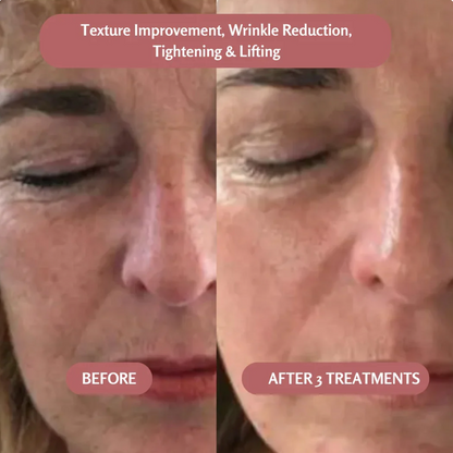 PureO2 - Bioactive Delivery MicrOxygenation