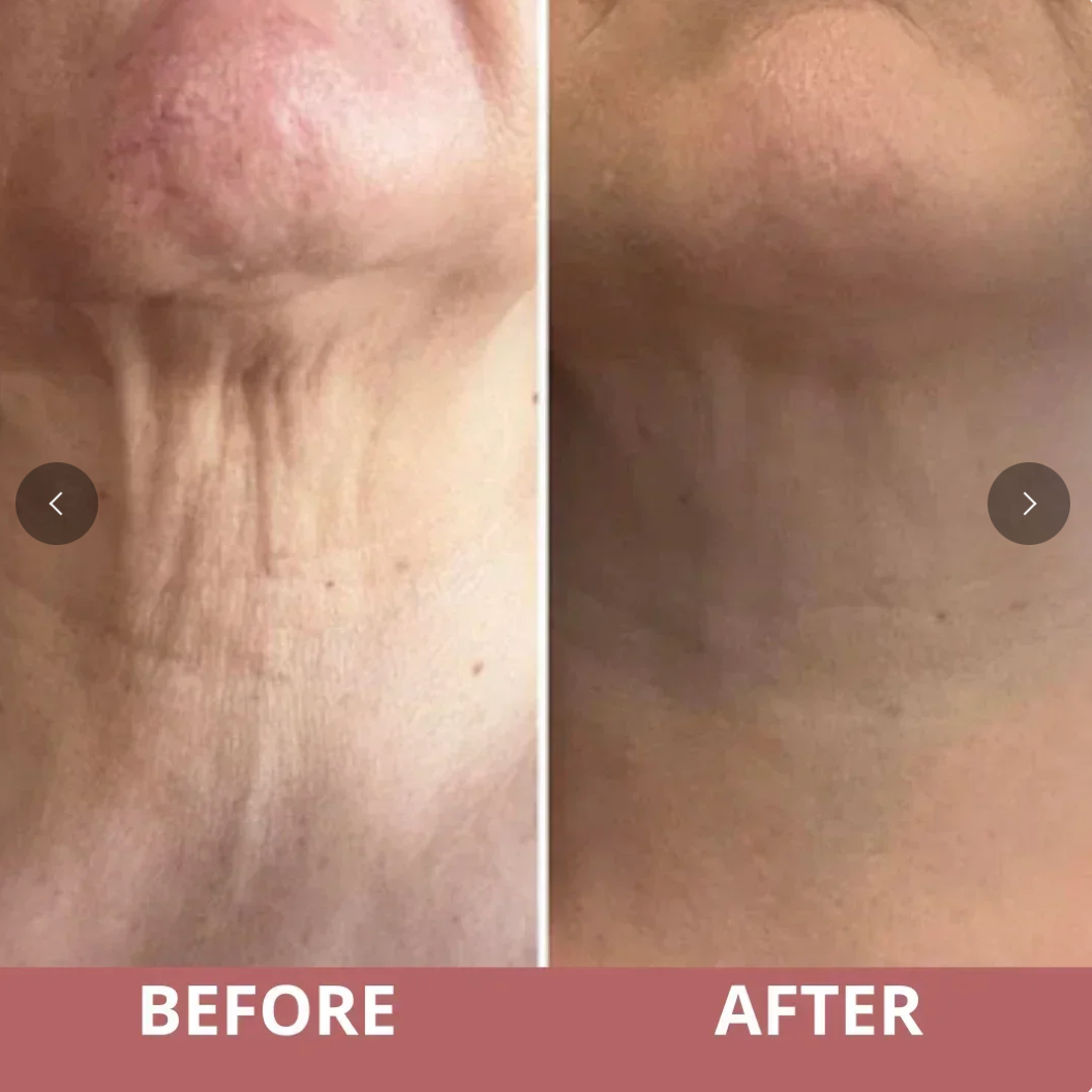 TIGHTEN & LIFT NECK CREAM by GlowlyBeauty